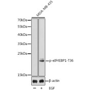 Western blot analysis of lysates from MDA-MB-435 cells, using Phospho-eIF4EBP1-T36 Antibody. Secondary antibody: HRP-conjugated Goat anti-Rabbit IgG (H+L) at 1/10000 dilution. Lysates/proteins: 25 µg per lane. Blocking buffer: 3% BSA.