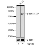 Western blot analysis of lysates from MCF7 cells using Phospho-ESRα-S167 Antibody. Secondary antibody: HRP-conjugated Goat anti-Rabbit IgG (H+L) at 1/10000 dilution. Lysates/proteins: 25 µg per lane. Blocking buffer: 3% BSA.
