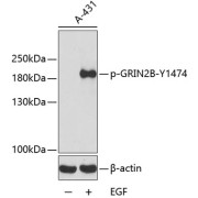 Western blot analysis of lysates from A431 cells, using Phospho-GRIN2B-Y1474 Antibody. Secondary antibody: HRP-conjugated Goat anti-Rabbit IgG (H+L) at 1/10000 dilution. Lysates/proteins: 25 µg per lane. Blocking buffer: 3% BSA.