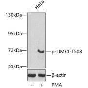 Western blot analysis of lysates from HeLa cells, using Phospho-LIMK1-T508 Antibody.