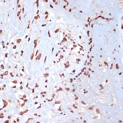 MAP Kinase-Activated Protein Kinase 2 Phospho-Thr334 (MAPKAPK2 pT334) Antibody