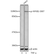 abx000463