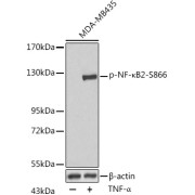 abx000465
