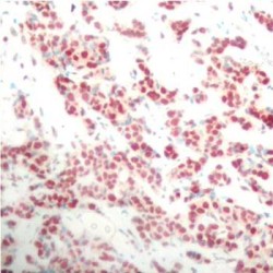 NFKB2 (pS866) Antibody