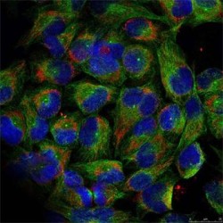 NFKB2 (pS866) Antibody