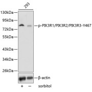 Western blot analysis of lysates from 293 cells, using Phospho-PI3KP85α/P55γ/P85β-Y467/Y464/Y199 Antibody. Secondary antibody: HRP-conjugated Goat anti-Rabbit IgG (H+L) at 1/10000 dilution. Lysates/proteins: 25 µg per lane. Blocking buffer: 3% BSA.