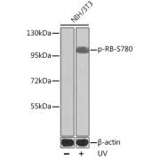 Western blot analysis of lysates from NIH/3T3 cells, using Phospho-RB-S780 Antibody at dilution. NIH/3T3 cells were treated by UV at room temperature for 15-30 minutes. Secondary antibody: HRP-conjugated Goat anti-Rabbit IgG (H+L) at 1/10000 dilution. Lysates/proteins: 25 µg per lane. Blocking buffer: 3% BSA.