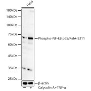 Western blot analysis of lysates from HeLa cells, using Phospho-NF-kB p65/RelA-S311 Antibody at 1/1000 dilution. HeLa cells were treated by TNF-α (20 ng/ml) and Calyculin A (100 nM) at 37 °C for 30 minutes after serum-starvation overnight. Secondary antibody: HRP-conjugated Goat anti-Rabbit IgG (H+L) at 1/10000 dilution. Lysates/proteins: 25 µg per lane. Blocking buffer: 3% nonfat dry milk in TBST. Exposure time: 60s.