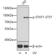 Western blot analysis of lysates from 293 cells, using Phospho-STAT1-S727 Antibody. Secondary antibody: HRP-conjugated Goat anti-Rabbit IgG (H+L) at 1/10000 dilution. Lysates/proteins: 25 µg per lane. Blocking buffer: 3% BSA.