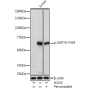 abx000515