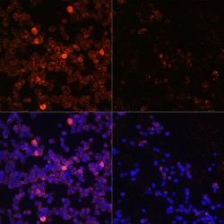 ZAP70 (pY493) Antibody