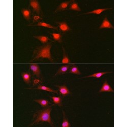 Mitogen-Activated Protein Kinase 1 Phospho-Thr185/Tyr187 and 3 Phospho-Thr202/Tyr204 (MAPK1 pT185/Y187/MAPK3 pT202/Y204) Antibody