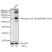 abx000518