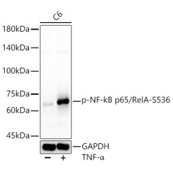 RELA (pS536) Antibody