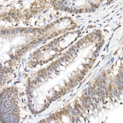 RELA (pS536) Antibody