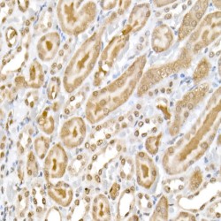 RELA (pS536) Antibody