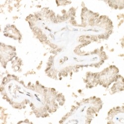Yes Associated Protein 1 Phospho-Ser127 (YAP1 pS127) Antibody