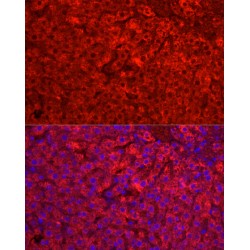 Cytochrome P450 1A2 (CYP1A2) Antibody
