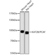 Western blot analysis of various lysates, using KAT2B/PCAF Antibody at 1/1000 dilution. Secondary antibody: HRP-conjugated Goat anti-Rabbit IgG (H+L) at 1/10000 dilution. Lysates/proteins: 25 µg per lane. Blocking buffer: 3% nonfat dry milk in TBST. Exposure time: 90s.