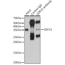 Growth Differentiation Factor 15 (GDF15) Antibody