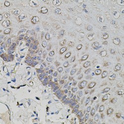 Amyloid-beta Precursor Protein (APP) Antibody