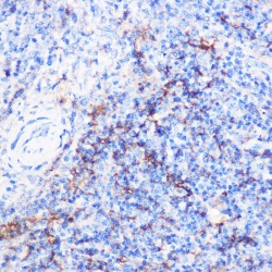 TNF Receptor Superfamily Member 5 / TNFRSF5 (CD40) Antibody