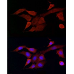 Docking Protein 4 (DOK4) Antibody