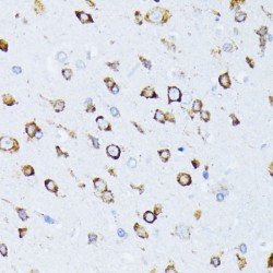 Endoplasmic Reticulum Chaperone BiP (HSPA5) Antibody