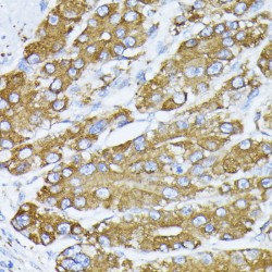 Endoplasmic Reticulum Chaperone BiP (HSPA5) Antibody