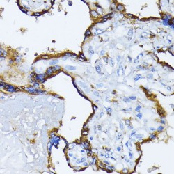Endoplasmic Reticulum Chaperone BiP (HSPA5) Antibody