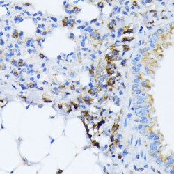Endoplasmic Reticulum Chaperone BiP (HSPA5) Antibody