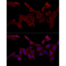 Insulin Receptor Substrate 1 (IRS1) Antibody