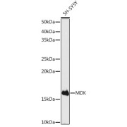 Western blot analysis of lysates from SH-SY5Y cells, using MDK Antibody at 1/500 dilution. Secondary antibody: HRP-conjugated Goat anti-Rabbit IgG (H+L) at 1/10000 dilution. Lysates/proteins: 25 µg per lane. Blocking buffer: 3% nonfat dry milk in TBST. Exposure time: 180s.