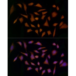 Midkine (MDK) Antibody