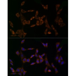 Midkine (MDK) Antibody