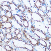 Western blot analysis of various lysates using NME1/NM23A Antibody at 1/1000 dilution. Secondary antibody: HRP-conjugated Goat anti-Rabbit IgG (H+L) at 1/10000 dilution. Lysates / proteins: 25 µg per lane. Blocking buffer: 3 % nonfat dry milk in TBST. Detection: ECL Basic Kit (RM00020). Exposure time: 1s.