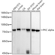 Western blot analysis of various lysates using PKC alpha Antibody at 1/500 dilution. Secondary antibody: HRP-conjugated Goat anti-Rabbit IgG (H+L) at 1/10000 dilution. Lysates/proteins: 25 µg per lane. Blocking buffer: 3% nonfat dry milk in TBST. Exposure time: 30s.