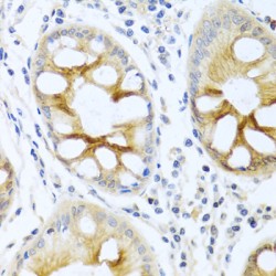 Protein Kinase C Alpha (PRKCA) Antibody