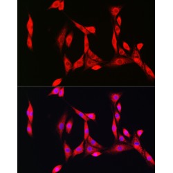 Superoxide Dismutase 1 (SOD1) Antibody