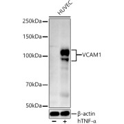 Western blot analysis of lysates from HUVEC cells, using VCAM1 Antibody at 1/500 dilution. HUVEC cells were treated by Human Tumor Necrosis Factor-α (hTNF-α) (10 ng/ml) for 16 hours. Secondary antibody: HRP-conjugated Goat anti-Rabbit IgG (H+L) at 1/10000 dilution. Lysates/proteins: 25 µg per lane. Blocking buffer: 3% nonfat dry milk in TBST. Exposure time: 90s.