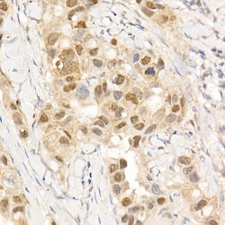 Tyrosine-Protein Kinase ABL1 (ABL1) Antibody