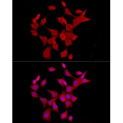 Interleukin 6 (IL6) Antibody
