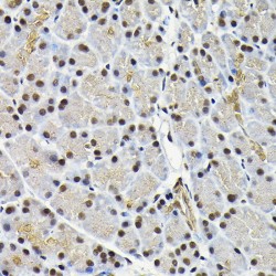 Mitogen-Activated Protein Kinase 8 / JNK1 (MAPK8) Antibody