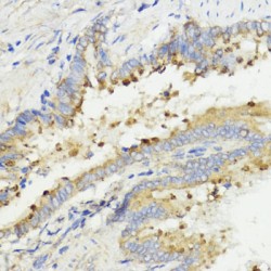 Insulin-Like Growth Factor I (IGF1) Antibody