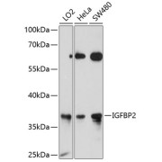 Western blot analysis of various lysates using IGFBP2 Antibody at 1/1000 dilution. Secondary antibody: HRP-conjugated Goat anti-Rabbit IgG (H+L) at 1/10000 dilution. Lysates/proteins: 25 µg per lane. Blocking buffer: 3% nonfat dry milk in TBST. Exposure time: 30s.