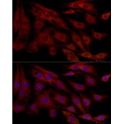 Induced Myeloid Leukemia Cell Differentiation Protein (MCL1) Antibody