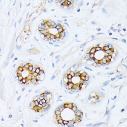 Fatty Acid Synthase (FASN) Antibody