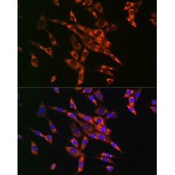 Fatty Acid Synthase (FASN) Antibody