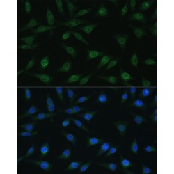 Nucleoporin 98 (NUP98) Antibody