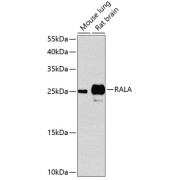 Western blot analysis of various lysates using RALA Antibody at 1/1000 dilution. Secondary antibody: HRP-conjugated Goat anti-Rabbit IgG (H+L) at 1/10000 dilution. Lysates/proteins: 25 µg per lane. Blocking buffer: 3% nonfat dry milk in TBST. Exposure time: 90s.